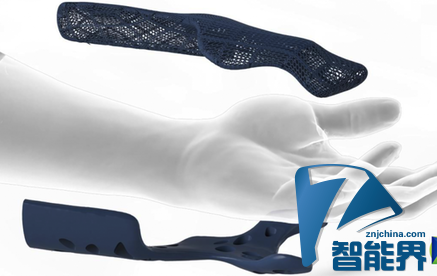 HEALX:用3D打印护具服务于肌肉损伤患者