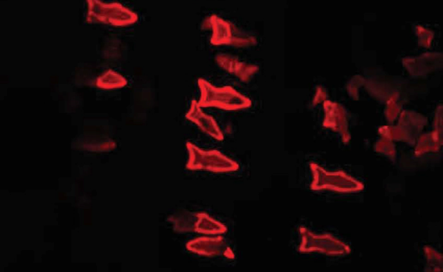血管中的微型机器鱼帮你清除体内毒素