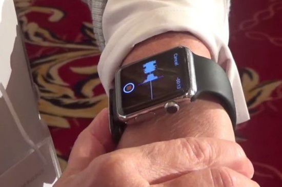 Apple Watch心电图配件：比心率监测更强大