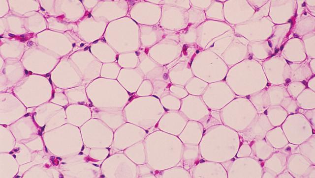 胖子的福音 纳米颗粒高科技减肥能粉碎脂肪