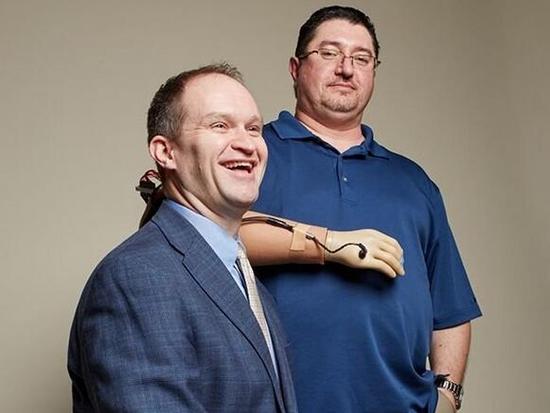 暖心！智能假肢让截肢者重获手心的温度